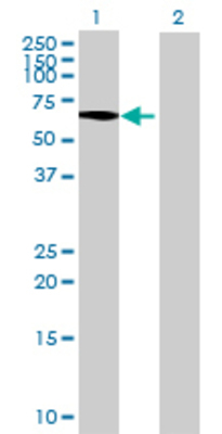 Lane 1: DAK transfected lysate (63.36 KDa) Lane 2: Non-transfected lysate.