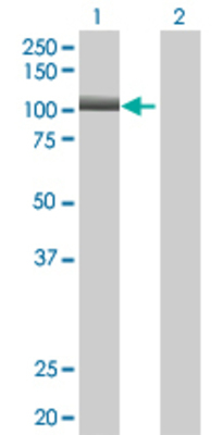 Lane 1: OCRL transfected lysate (103.2 KDa) Lane 2: Non-transfected lysate.