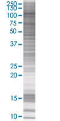OCRL transfected lysate.