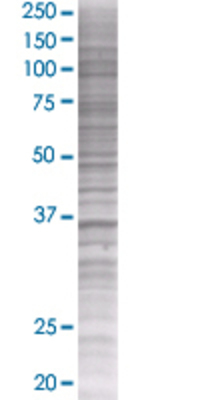 SDSL transfected lysate.