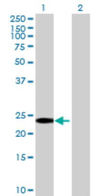Lane 1: RGS8 transfected lysate (21.89 KDa) Lane 2: Non-transfected lysate.