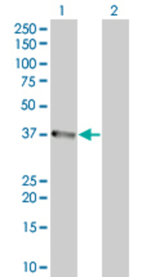 Lane 1: CTSS transfected lysate (36.52 KDa). Lane 2: Non-transfected lysate.