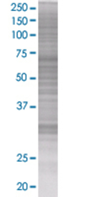 CCND2 transfected lysate.