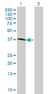Lane 1: MAN1A1 transfected lysate (40.48 KDa) Lane 2: Non-transfected lysate.