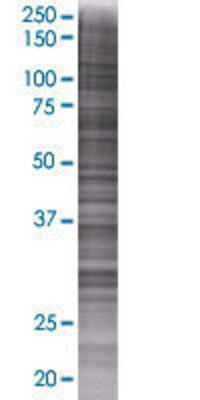 TSKU transfected lysate.