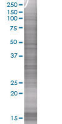 CTSS transfected lysate