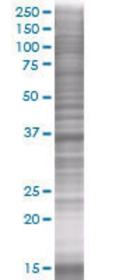FBP1 transfected lysate.