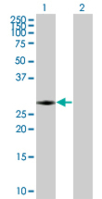 Lane 1: RAB40A transfected lysate (31.1 KDa) Lane 2: Non-transfected lysate.