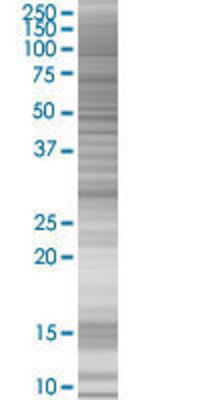 ZNF2 transfected lysate.