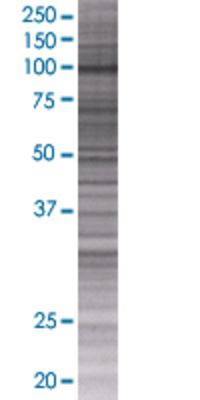 ITPKC transfected lysate.