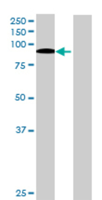 Lane 1: ITPKC transfected lysate (75.24 KDa) Lane 2: Non-transfected lysate.