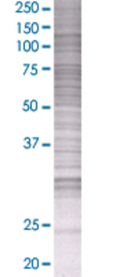 RPAP3 transfected lysate.