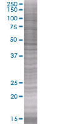 PARD6A transfected lysate