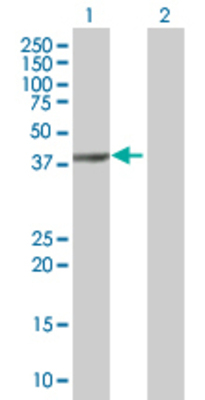 Lane 1: PARD6A transfected lysate (37.3 KDa). Lane 2: Non-transfected lysate.