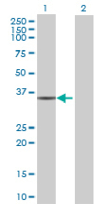 Lane 1: LGALS8 transfected lysate (34.98 KDa) Lane 2: Non-transfected lysate.