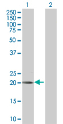 Lane 1: C1QTNF2 transfected lysate (30 KDa) Lane 2: Non-transfected lysate.