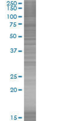 EAF2 transfected lysate.
