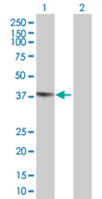 Lane 1: EAF2 transfected lysate (28.71 KDa) Lane 2: Non-transfected lysate.