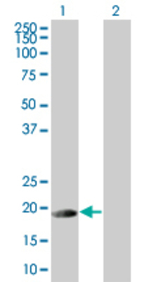 Lane 1: DCTD transfected lysate (20.9 KDa) Lane 2: Non-transfected lysate.