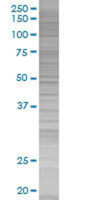 DCTD transfected lysate.