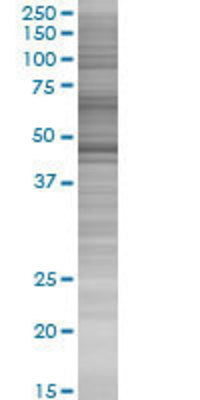 NEIL1 transfected lysate.