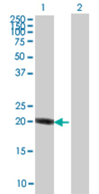 Lane 1: THRAP6 transfected lysate (19.69 KDa) Lane 2: Non-transfected lysate.
