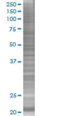 THRAP6 transfected lysate.