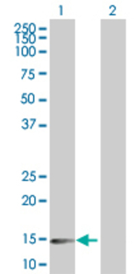Lane 1: DCTN3 transfected lysate (19.5 KDa) Lane 2: Non-transfected lysate.