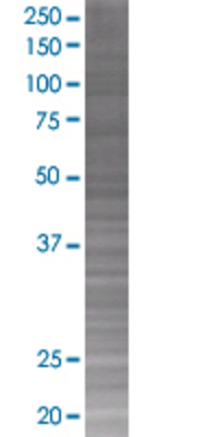 DCTN3 transfected lysate.