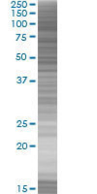 NKRF transfected lysate.