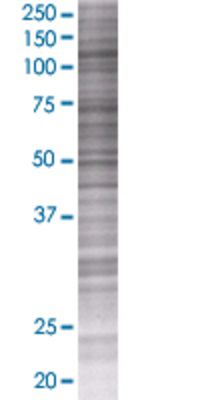 CCNF transfected lysate.