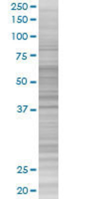MS4A1 transfected lysate.