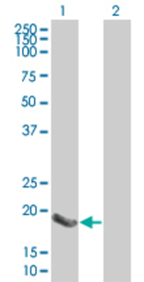 Lane 1: DUSP14 transfected lysate (21.89 KDa) Lane 2: Non-transfected lysate.
