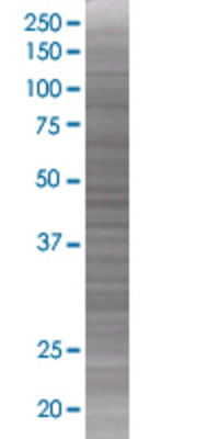 GALNT3 transfected lysate