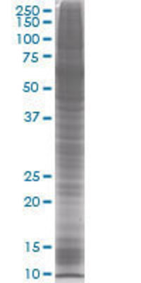 MDK transfected lysate