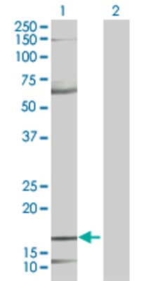Lane 1: MDK transfected lysate (15.84 KDa). Lane 2: Non-transfected lysate.