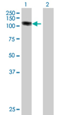 Lane 1: ZNF408 transfected lysate (79.31 KDa) Lane 2: Non-transfected lysate.