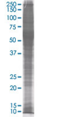 MPPED1 transfected lysate