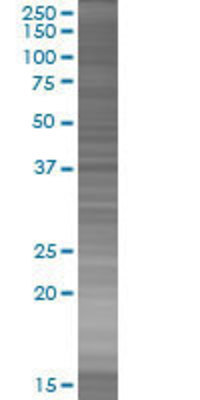 SERPINB9 transfected lysate.