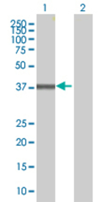 Lane 1: SERPINB9 transfected lysate (42.4 KDa) Lane 2: Non-transfected lysate.