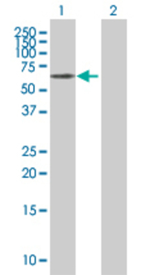 Lane 1: MAP2 transfected lysate (49.6 KDa) Lane 2: Non-transfected lysate.