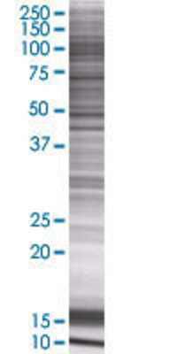 CPXM1 transfected lysate.