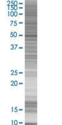 RBM9 transfected lysate.