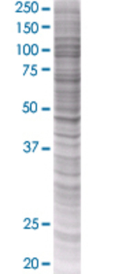 ORM1 transfected lysate.