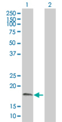 Lane 1: NME3 transfected lysate (19 KDa). Lane 2: Non-transfected lysate.