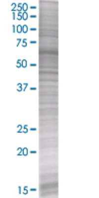 NME3 transfected lysate