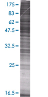 NFIC transfected lysate.