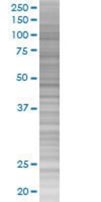 NDUFV2 transfected lysate.