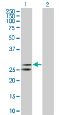 Lane 1: NDUFV2 transfected lysate (27.5 KDa) Lane 2: Non-transfected lysate.