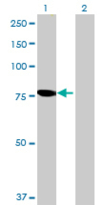 Lane 1: PGM2L1 transfected lysate (68.53 KDa) Lane 2: Non-transfected lysate.